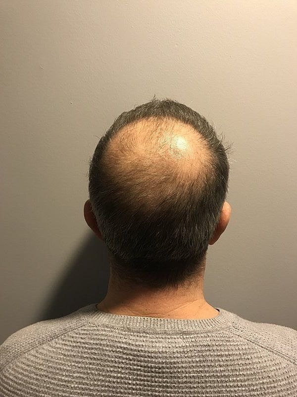 Before & After