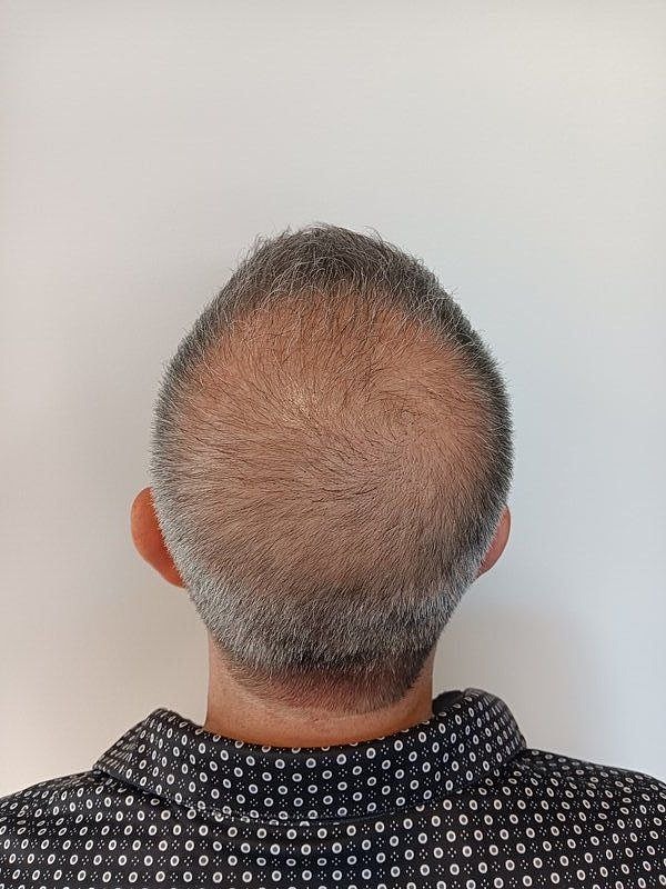Before & After